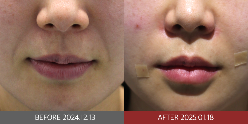 KakaoTalk_20250131_151140359_01 | 미담의원