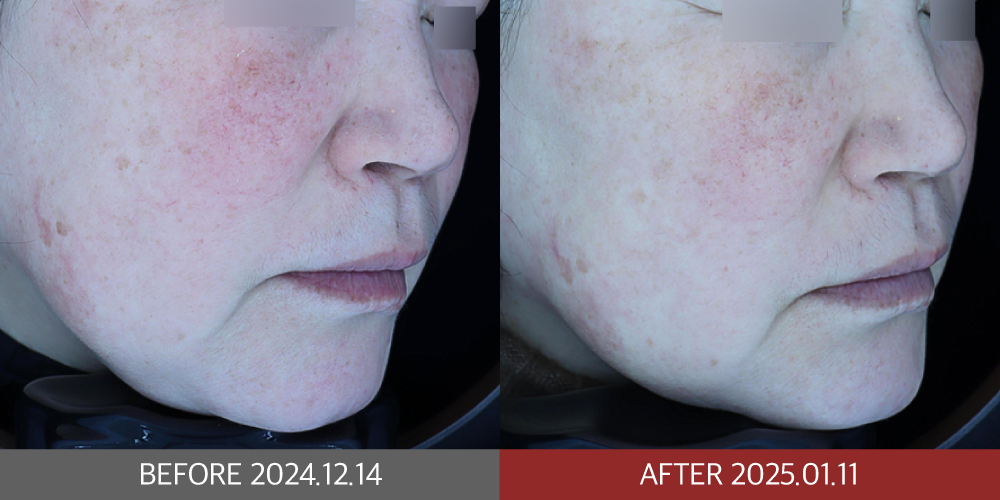 KakaoTalk_20250212_202540192 | 미담의원