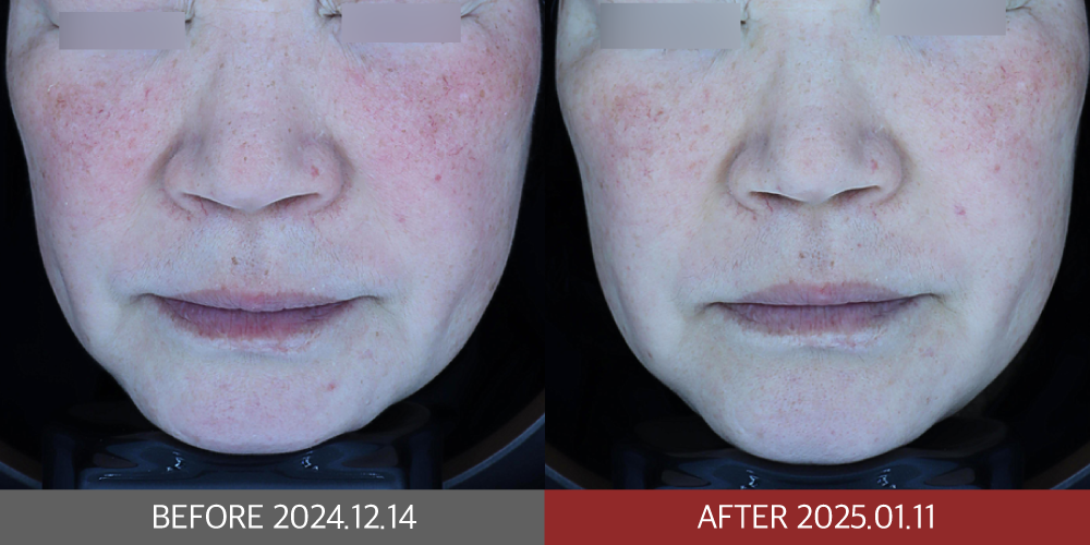 KakaoTalk_20250212_202540192_01 | 미담의원