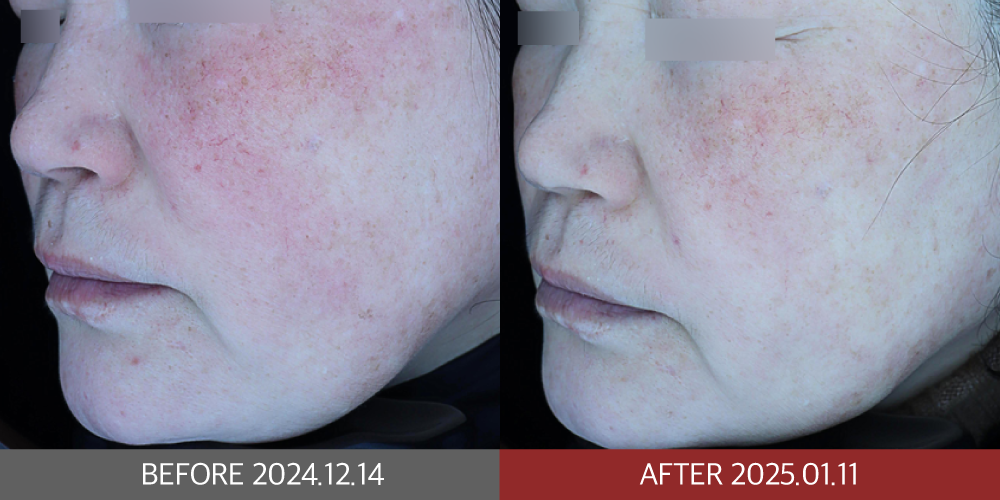 KakaoTalk_20250212_202540192_02 | 미담의원