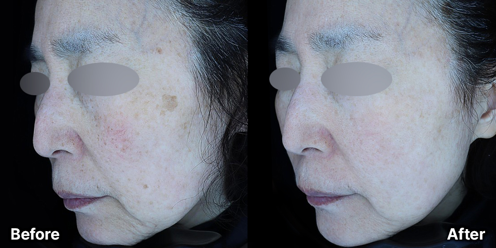 KakaoTalk_20250808_165054475 | 미담의원