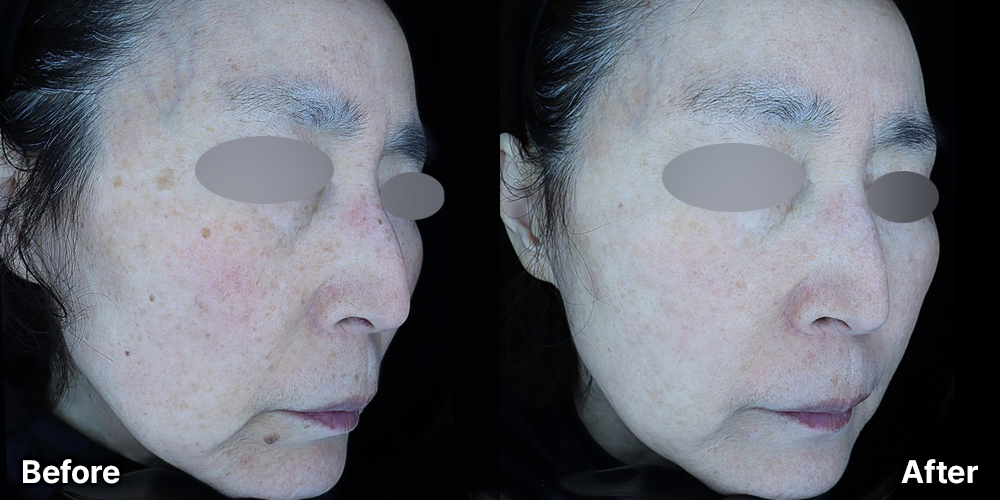 KakaoTalk_20250808_165054475_01 | 미담의원