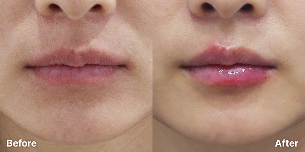 KakaoTalk_20250922_113729388_01 | 미담의원