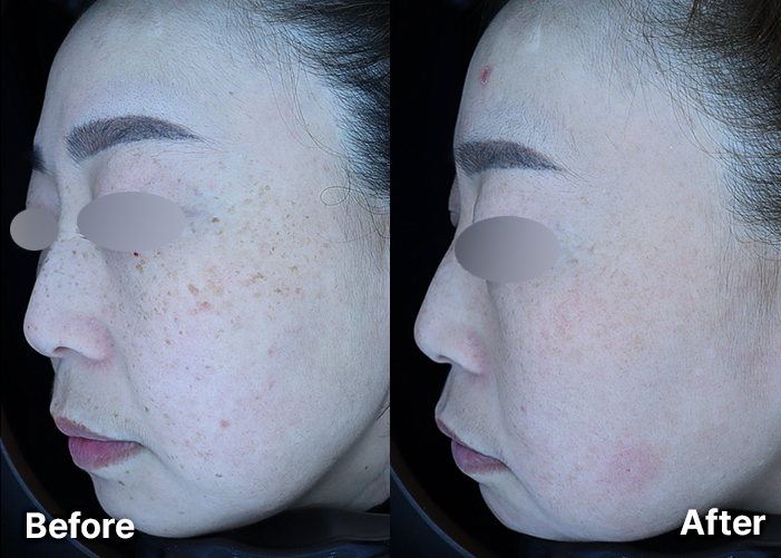 KakaoTalk_20251015_123505700 | 미담의원