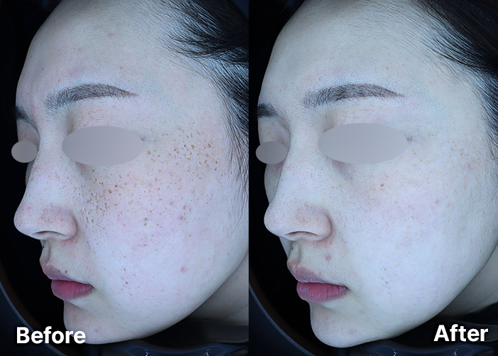 KakaoTalk_20251119_095127103_02 | 미담의원