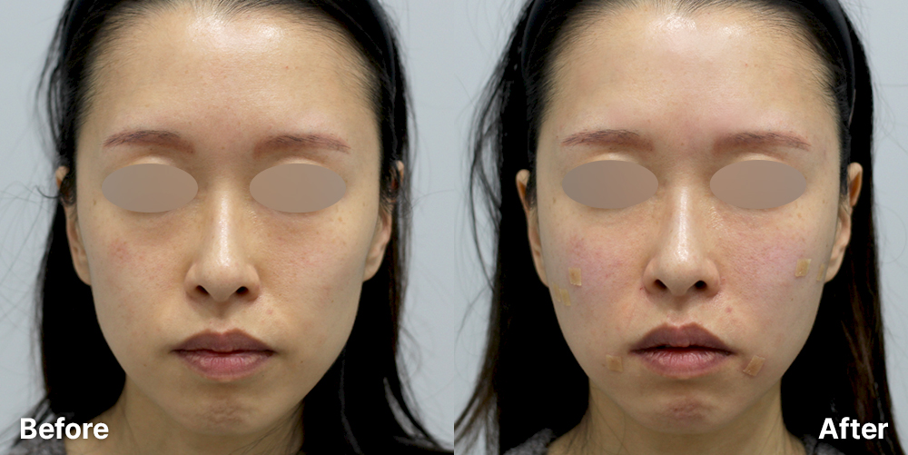 KakaoTalk_20251223_184030794 | 미담의원